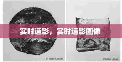 实时造影，实时造影图像 