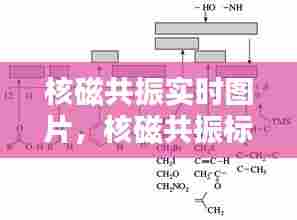 核磁共振实时图片，核磁共振标准图谱 