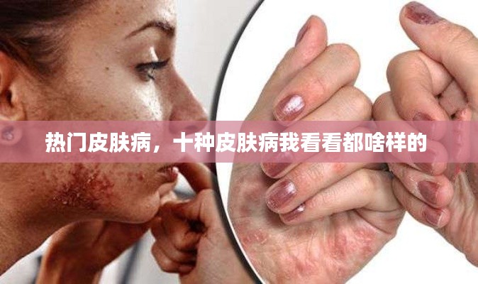 热门皮肤病，十种皮肤病我看看都啥样的 