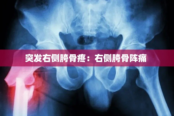 突发右侧胯骨疼：右侧胯骨阵痛 