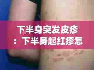 下半身突发皮疹:下半身起红疹怎么回事