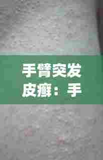 手臂突发皮癣:手臂上皮肤藓