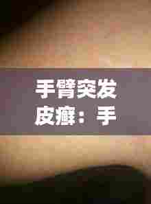 手臂突发皮癣:手臂上皮肤藓