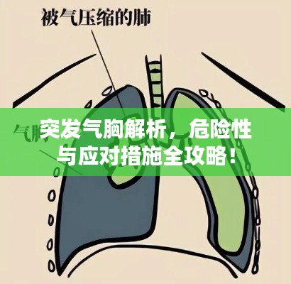 突发气胸解析，危险性与应对措施全攻略！