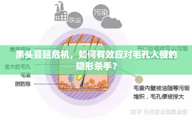 黑头蔓延危机，如何有效应对毛孔入侵的隐形杀手？