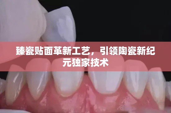 臻瓷贴面革新工艺，引领陶瓷新纪元独家技术