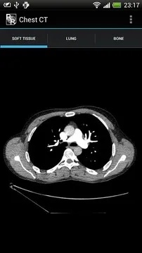 官方的盒子下载,诠释说明解析 CT_v2.377